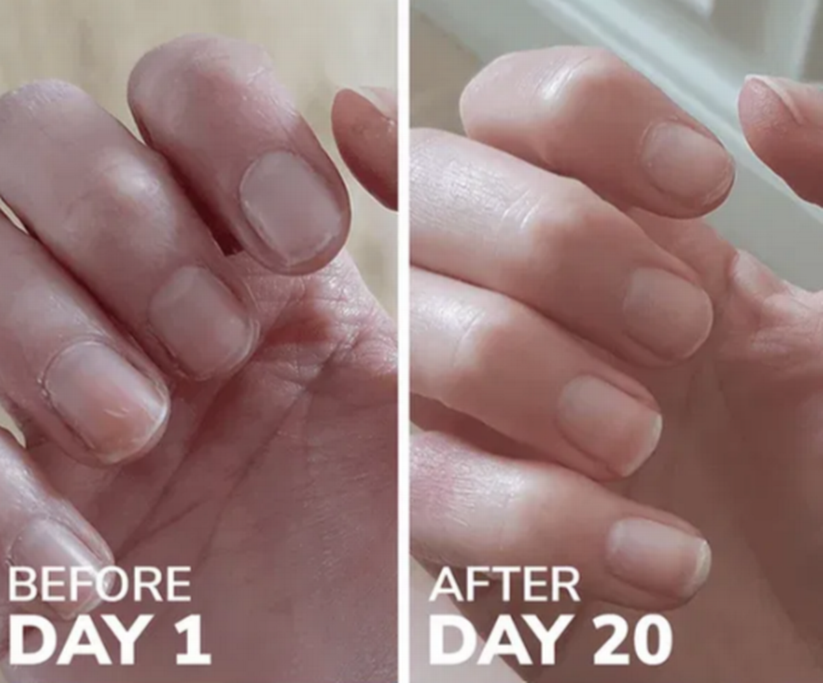 The Reverse Life supplement can help improve nails, hair and skin