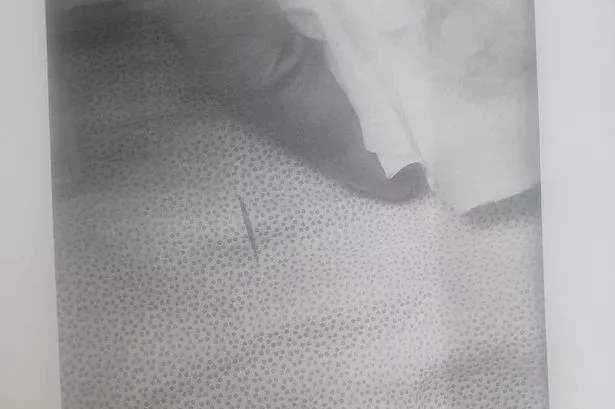 One of the holes in the tray wraps in the HSDU unit of Unversity Hospital of Wales