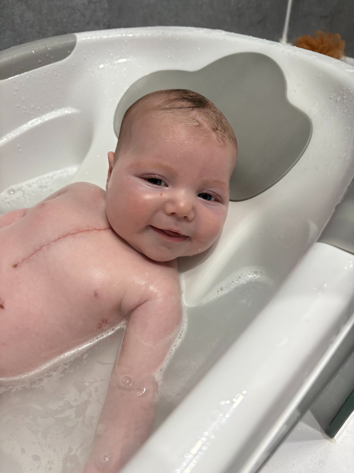 Dolly after her second surgery 