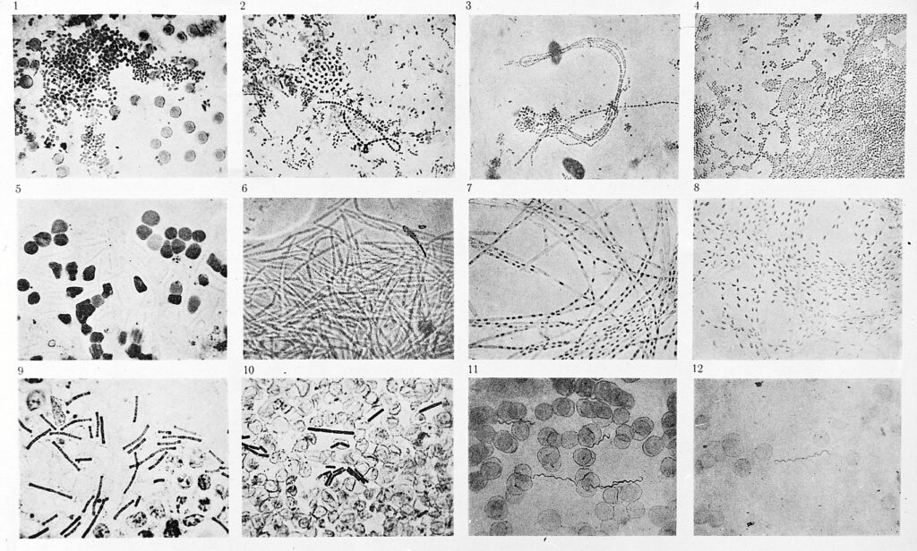 12 slides of bacteria photographed by Robert Koch (1877)