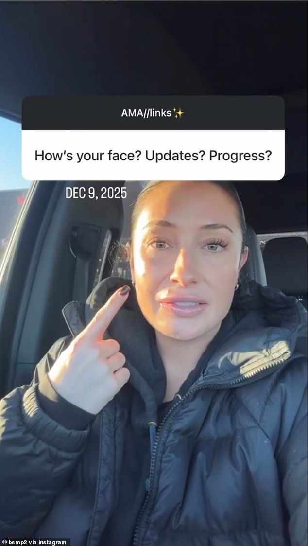 Bristol Palin used Instagram to give her followers an update on her facial paralysis condition on Saturday