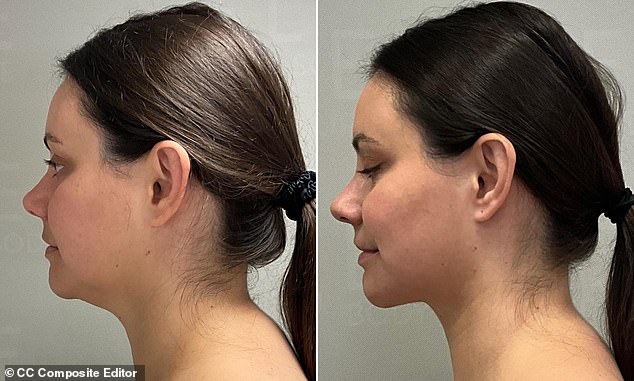 ... and how she looked before and after the treatment