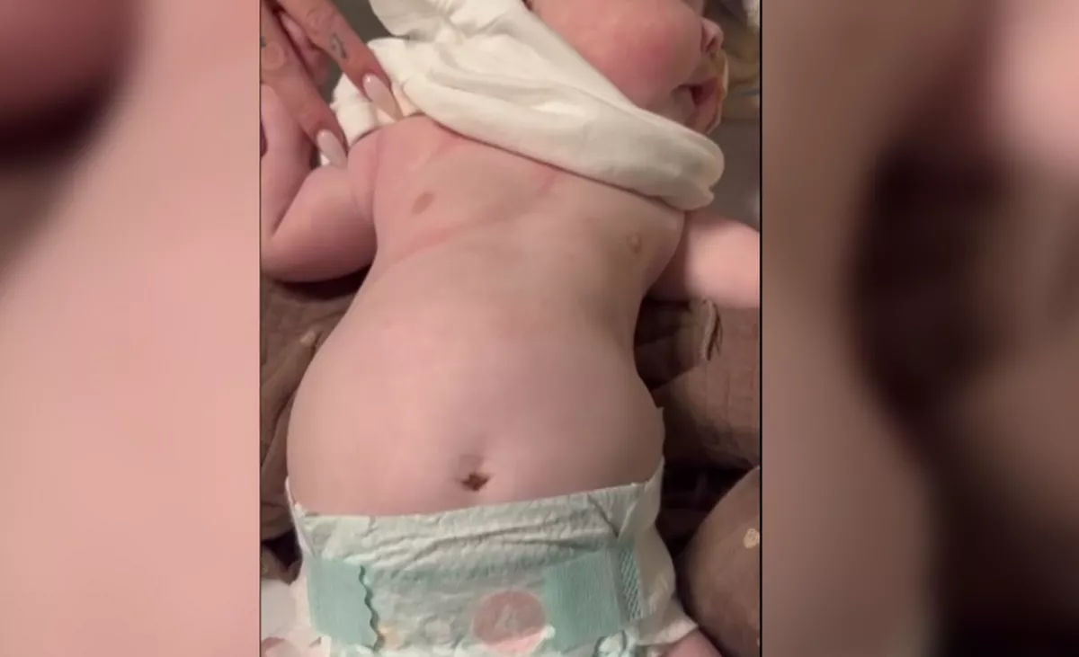 Jesy shared a new video of her twins' worrying breathing on This Morning