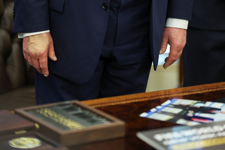 A closeup of Trump's hands, with one covered in makeup