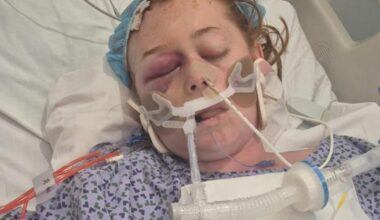 Accrington family left with £125k medical bills after cancer diagnosis