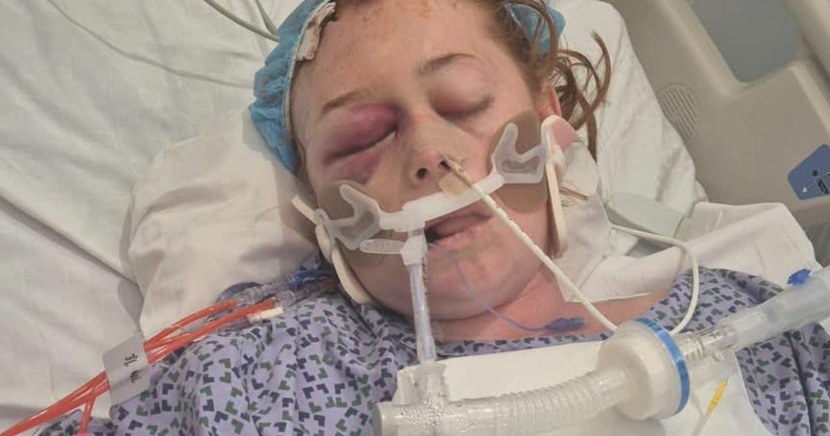 Accrington family left with £125k medical bills after cancer diagnosis