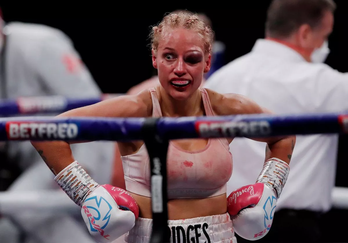 Ebanie Bridges was left with a huge swelling over her left eye following her brutal bout with Shannon Courtenay