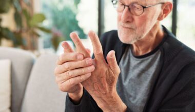 NHS message to anyone taking medication for arthritis