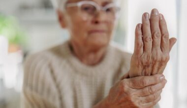 NHS alert to anyone taking common medication for osteoarthritis