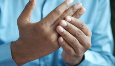 A Brazilian Plant May Help Treat Arthritis