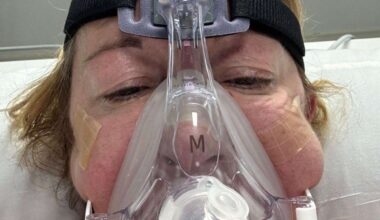 Maidstone mum gets Legionnaires’ disease during holiday at TUI BLUE Suite Princess in Playa Taurito, Gran Canaria