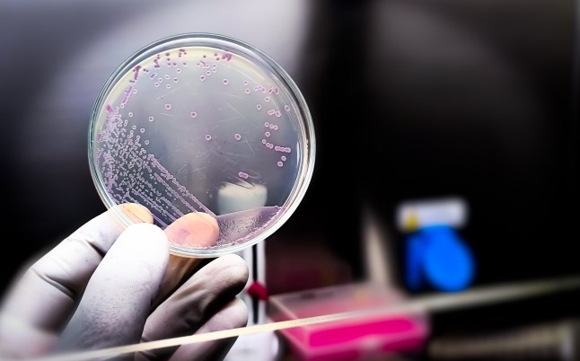 A microbiological culture Petri dish with a colonies of the pathogenic bacterium Escherichia coli (E. coli)