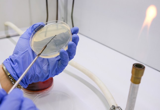 photo of culture bacteria by usin steel loop