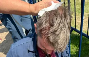 Fan at The Open left floored and bloodied by wayward Scott drive - but gets present after