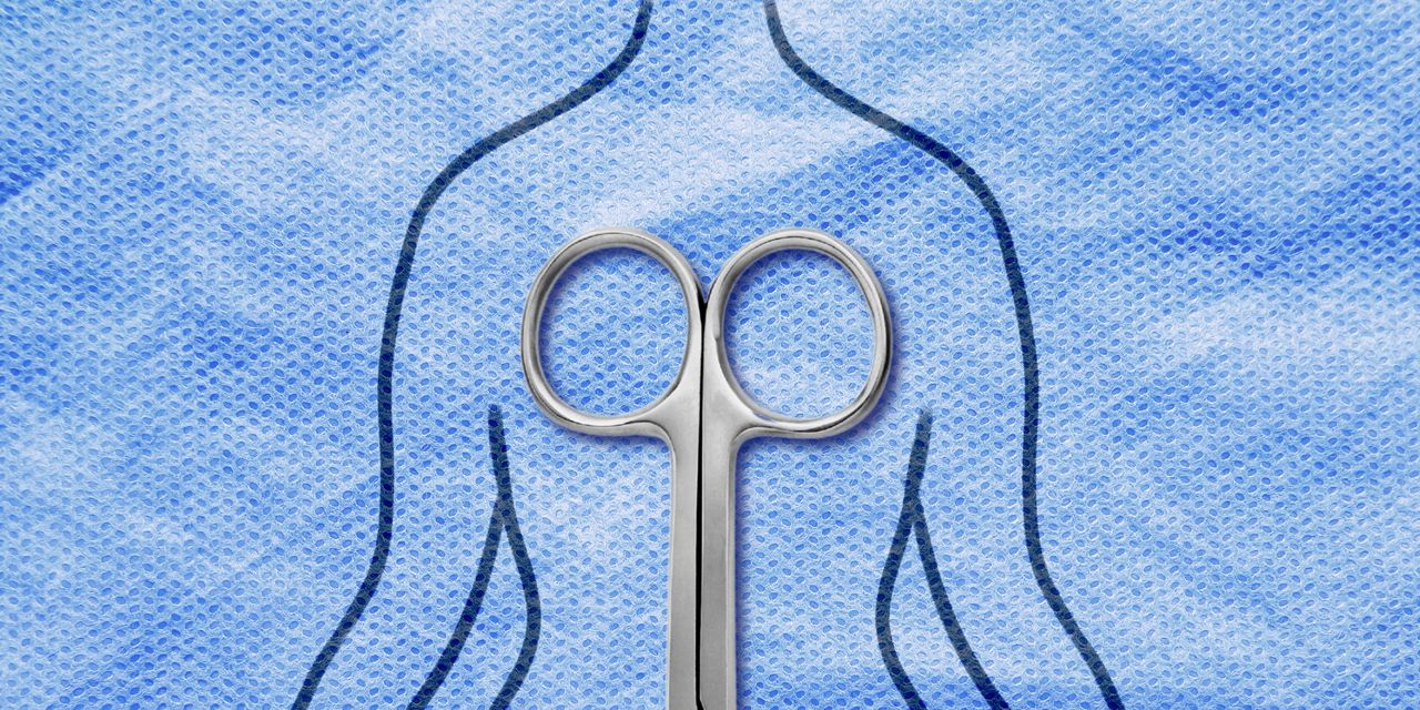 I’m a Psychiatrist Who Treats Body Image Issues. I Also Got a Mommy Makeover