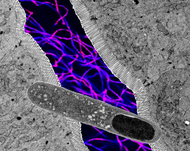 Researchers Discovered a Gut Microbe That Can Singlehandedly Halt Weight Gain in Mice