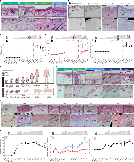 Rete ridges form via evolutionarily distinct mechanisms in mammalian skin