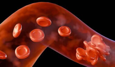 FDA says recalled blood thinner sold across the US is unlikely to cause serious harm