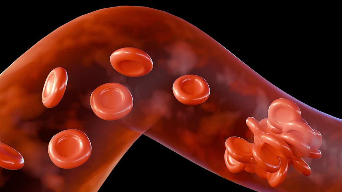 FDA says recalled blood thinner sold across the US is unlikely to cause serious harm