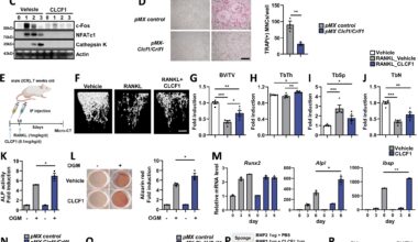 Exercise-induced protein revives aging muscles and bones, researchers discover