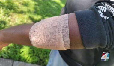 Mother of frightened 18-year-old injured in playground shooting speaks out