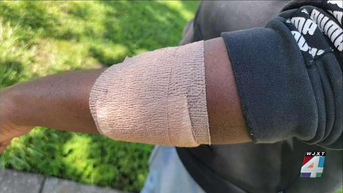 Mother of frightened 18-year-old injured in playground shooting speaks out