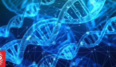 Genetic marker found for rare children's brain disease