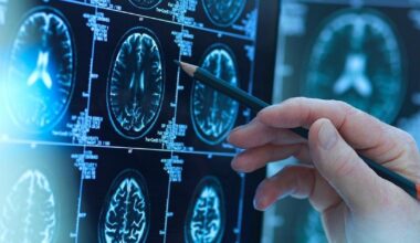 How a Baby’s Brain Grows in the First Years of Life | Health