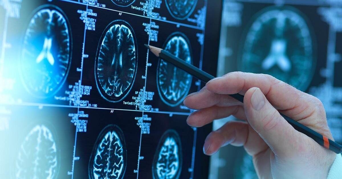 How a Baby’s Brain Grows in the First Years of Life | Health