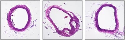 Gene Editing Treats Smooth Muscle Disease in Preclinical Model