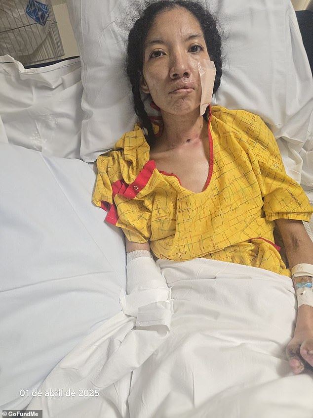 While Munoz was also warned that she may die from sepsis and necrotizing fasciitis the same night doctors diagnosed her with the infections, she miraculously survived