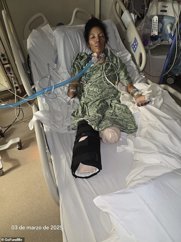 Arisbeth Munoz, 39, lost her right leg below the knee, her left leg above the knee, her right arm and her left hand due to sepsis and necrotizing fasciitis