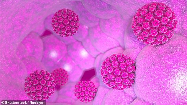 Anal cancer is on the rise, with specialist Dr. Evan Goldstein sharing a little-known warning sign that can increase the risk, which he dubs a 'silent disease'