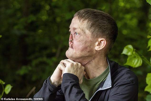 Mr Brogan claims doctors dismissed his worries about his ongoing nose pain and that he believes his cancer could have been caught earlier