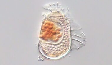 Strange Cellular Entity Challenges Very Definition of Life Itself : ScienceAlert