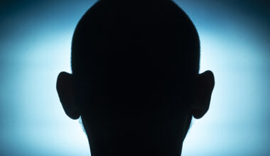 Scientists Beamed Light Right Through a Man's Head For The First Time : ScienceAlert
