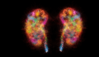 Parkinson's Disease Might Not Start in The Brain, Study Finds : ScienceAlert