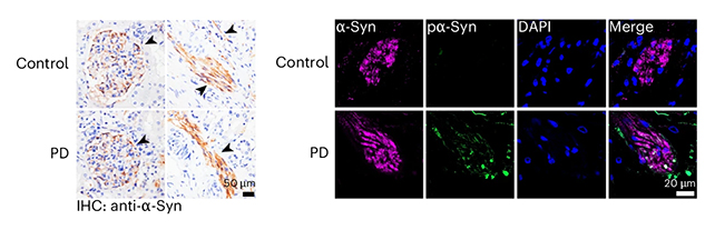 Protein levels chart