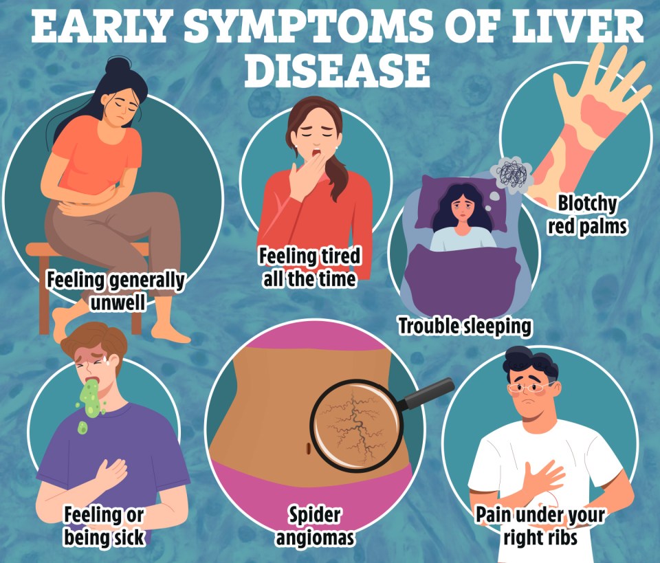 Illustration of early liver disease symptoms: feeling unwell, tired, trouble sleeping, blotchy red palms, nausea, spider angiomas, and pain under the right ribs.
