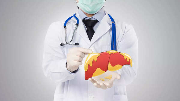 fatty liver