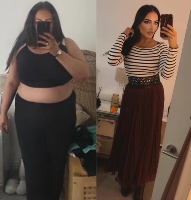 Before and after photos of a woman's weight loss journey.
