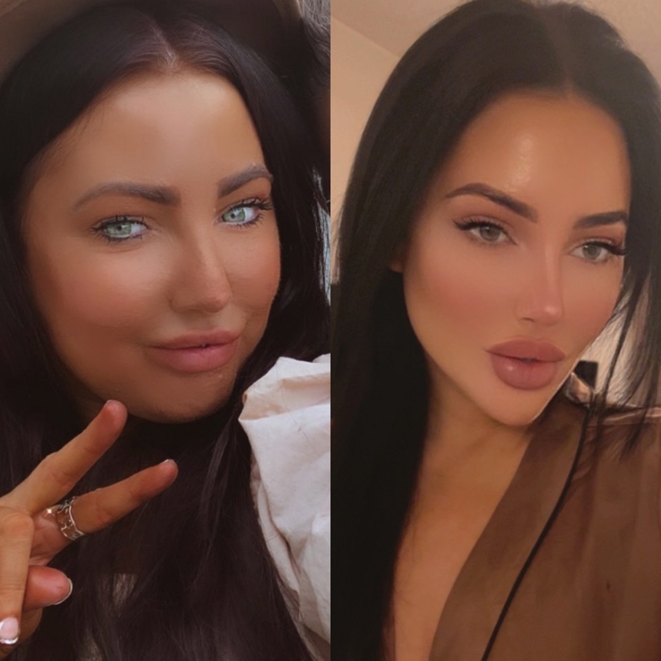 Before and after photos of a woman's weight loss.