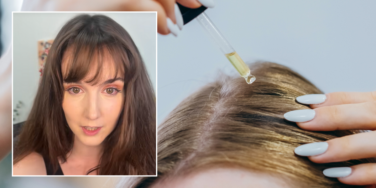 'I reversed thinning around with a supplement that boosts growth by 40%'