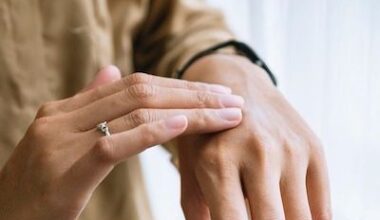 Study Highlights Predictors of Atopic Dermatitis Flares Using Machine Learning