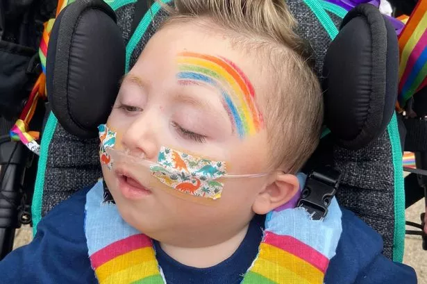 Little Alexander McMillan who died last year after living with a genetic condition called WWOX