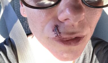 Jillian Osbourne needed 37 stitches in her face after a customer's dog attacked her in the pet store she worked at
