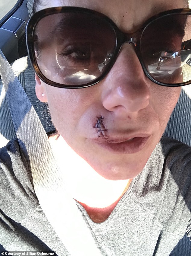 Jillian Osbourne needed 37 stitches in her face after a customer's dog attacked her in the pet store she worked at