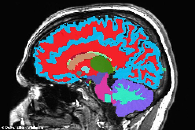 Those with more fluid and a smaller hippocampus had brains far older than the average 45-year-old