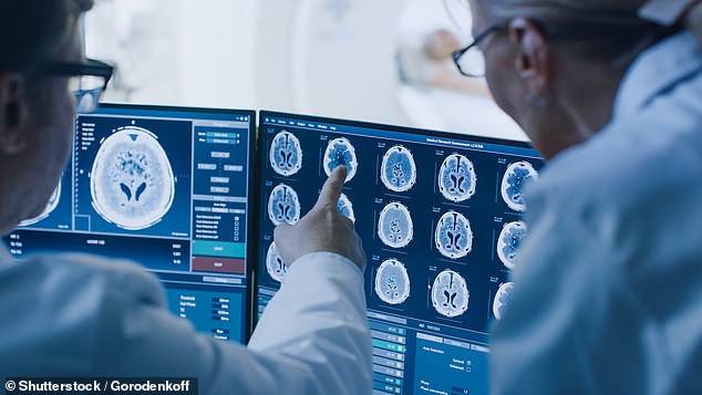 At the emergency room, doctors informed her that she had a tumor called a meningioma the size of an apple pressing on the left side of her brain (stock image)