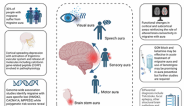 What does a migraine aura look like?—A systematic review | The Journal of Headache and Pain